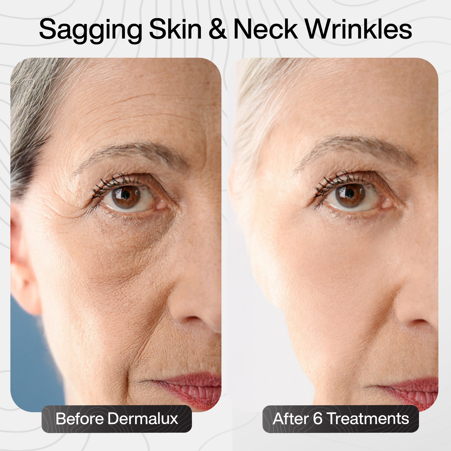 PDRN Advanced Infusion Treatment