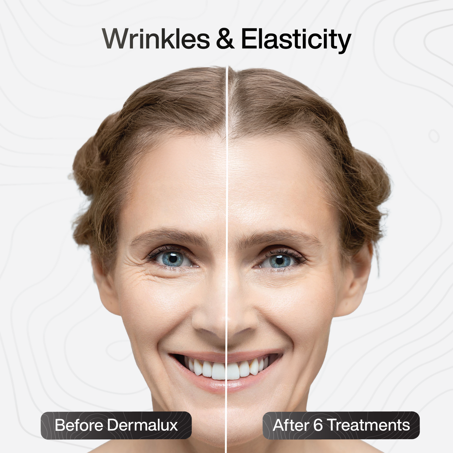 PDRN Advanced Infusion Treatment