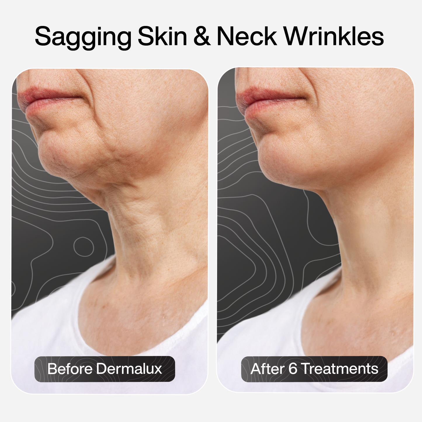 PDRN Advanced Infusion Treatment