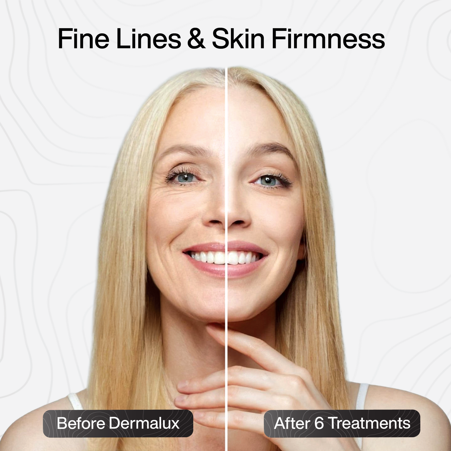 PDRN Advanced Infusion Treatment